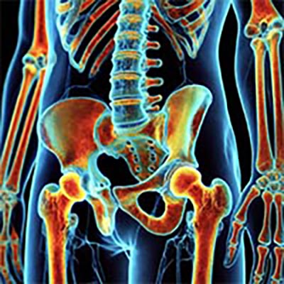 ClearView Imaging Bone Density Scan